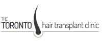The Toronto Hair Transplant Clinic image 1